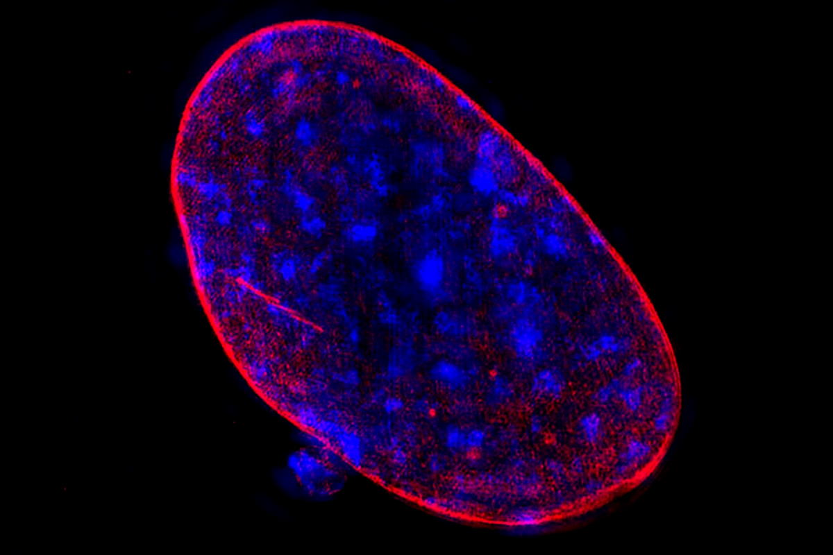 Cancro nuova scoperta : un gruppo di ricercatori pubblica su Nature un interessante ricerca sulla aneuploidia delle cellule cancerogene.