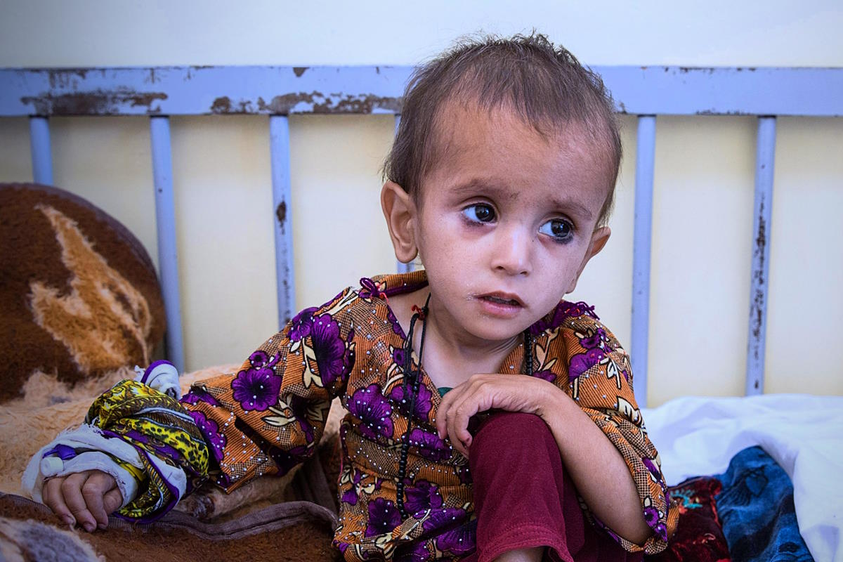 In Afghanistan il personale sanitario non può far altro che veder morire i bambini