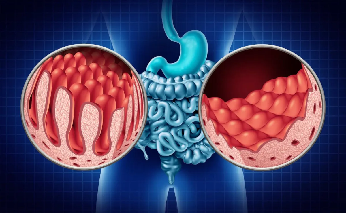 Celiachia e genetica: uno studio norvegese svela nuove associazioni