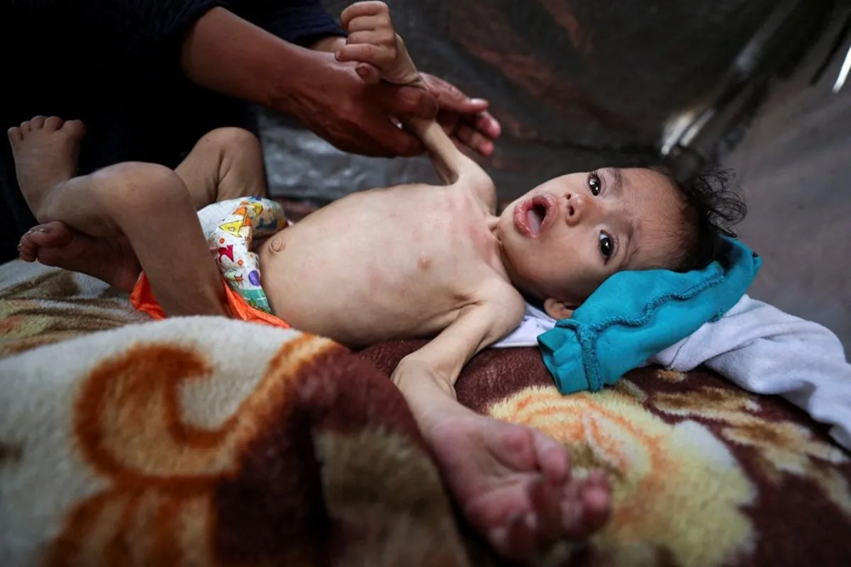 UNICEF: a Gaza sono più di 5.000 i bambini a cui a maggio è stata diagnosticata la malnutrizione...